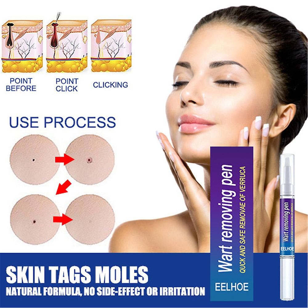 "Warts Remover Cream – Skin Tag & Mole Treatment Ointment"