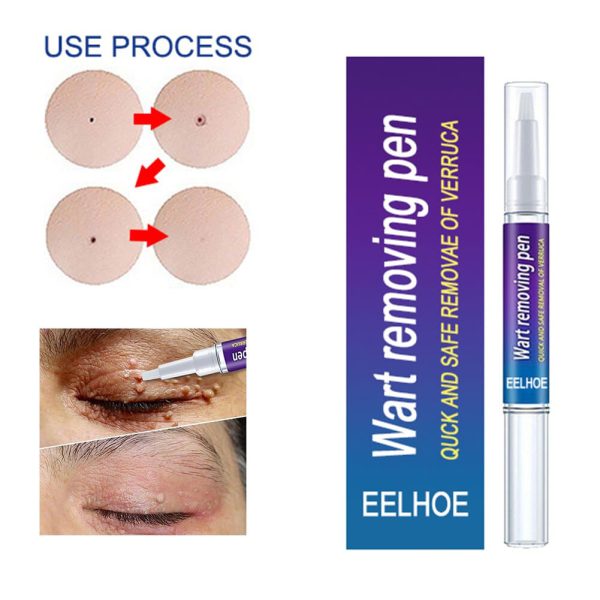 "Warts Remover Cream – Skin Tag & Mole Treatment Ointment"